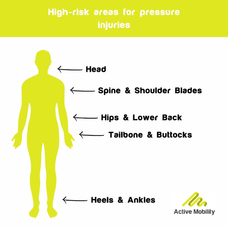 High risk areas for pressure sores